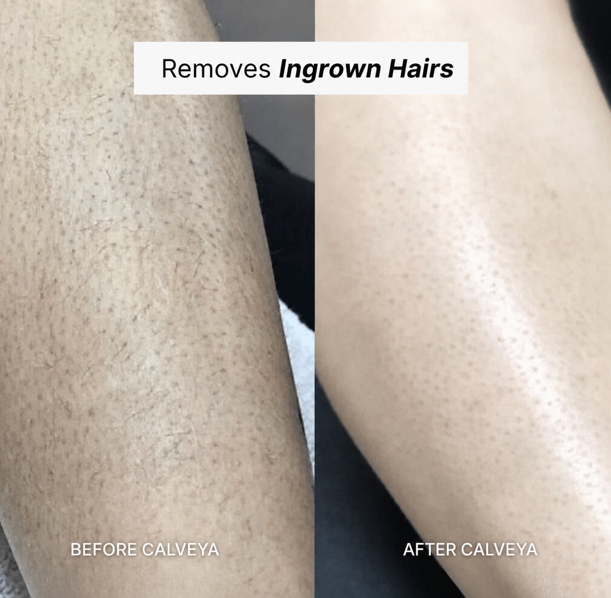Razor Calveya 5in1