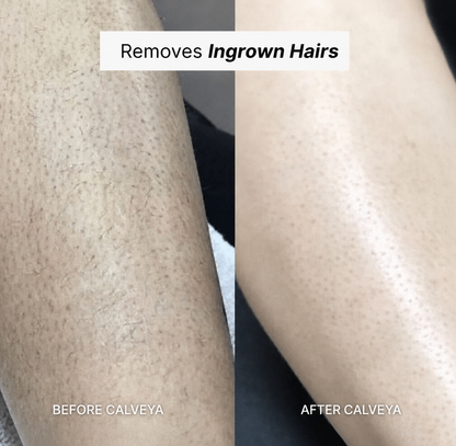 Razor Calveya 5in1