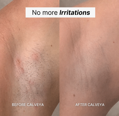 Razor Calveya 5in1